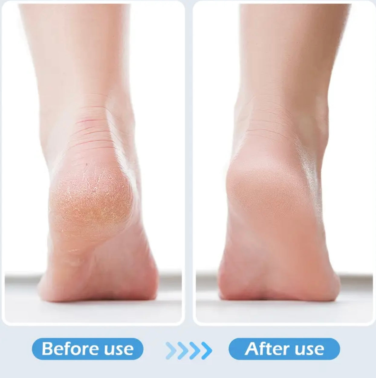 4-in-1 Foot Care Brush – Pumice, Sandpaper & Toenail Grooming Tool