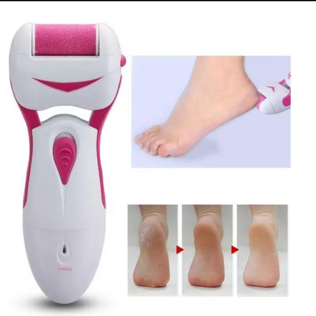 Electric Callus Remover RF-555Z – Portable Electronic Foot File & Pedicure Tool