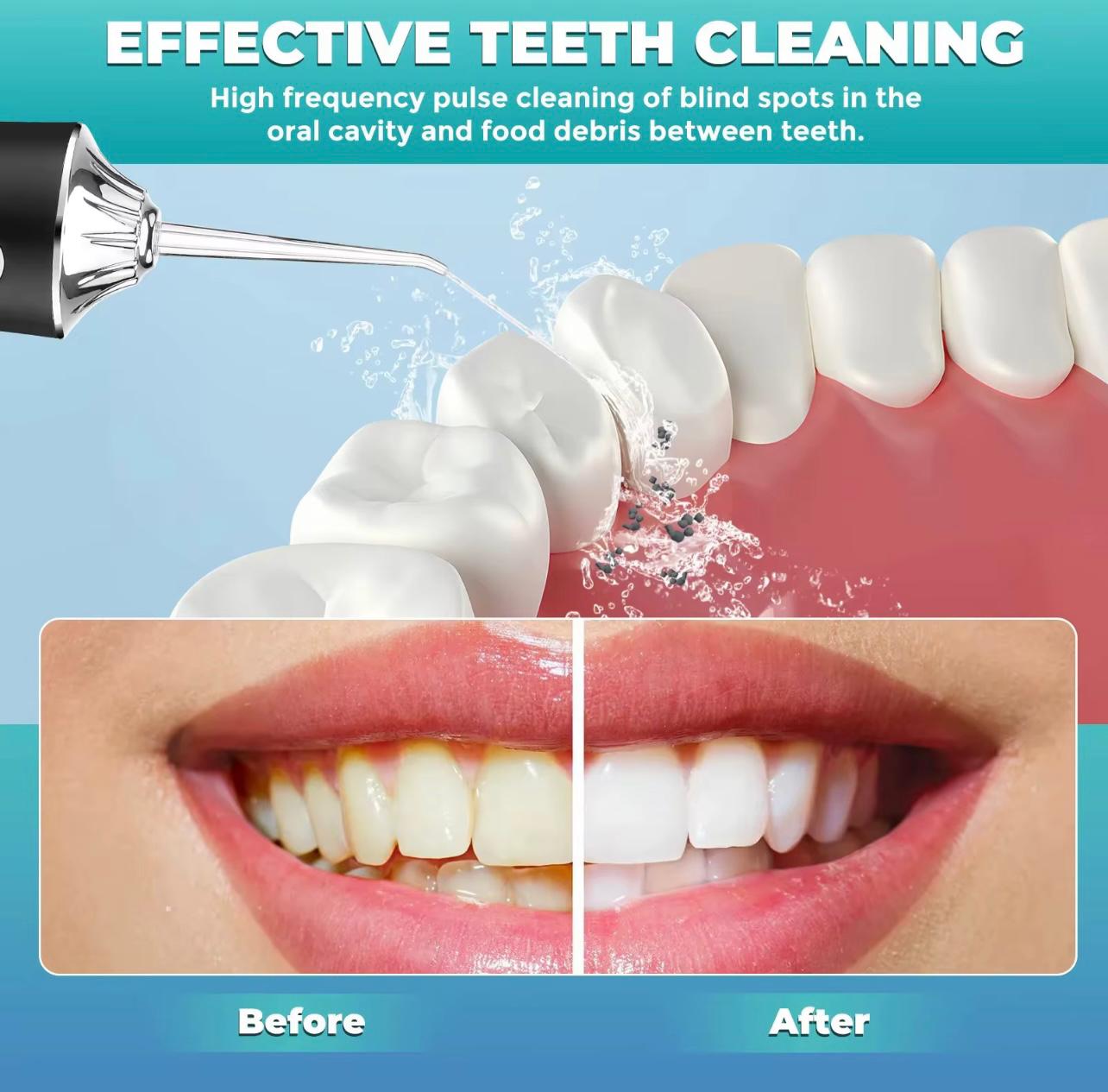 Electric Rechargeable Tooth Cleaner with 4 Nozzles for Daily Oral Cleaning..