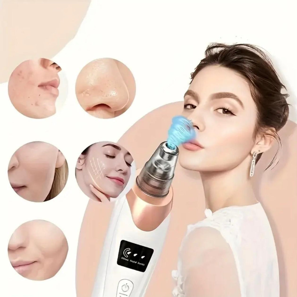 مجموعة إزالة الرؤوس السوداء وتنظيف المسام القابلة لإعادة الشحن - تنظيف عميق، شحن USB وشفط قابل للتعديل